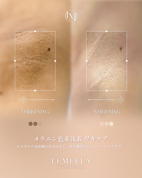 https://beautysalon-cocoadoll.com/wp-content/uploads/2025/06/01_beforeafter.jpg