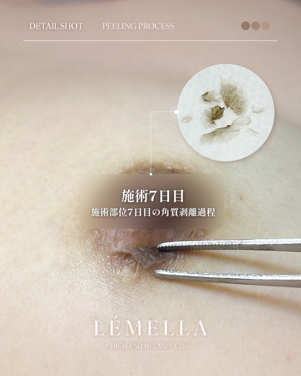 https://beautysalon-cocoadoll.com/wp-content/uploads/2025/06/02_beforeafter-1.jpg