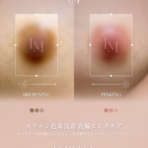 脱毛後の黒ずみ解消！！