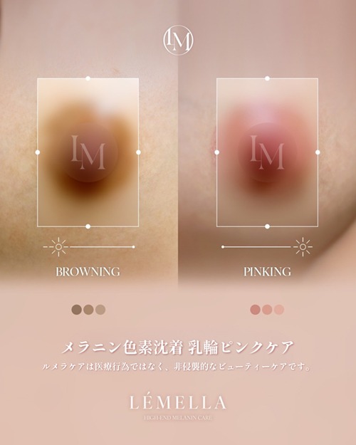 https://beautysalon-cocoadoll.com/wp-content/uploads/2025/06/03_beforeafter.jpg