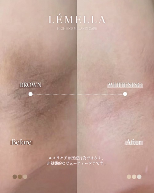 https://beautysalon-cocoadoll.com/wp-content/uploads/2025/06/04_beforeafter.jpg
