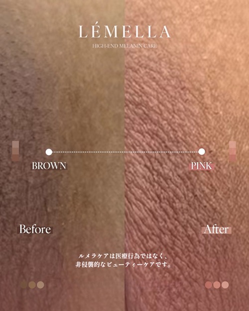 https://beautysalon-cocoadoll.com/wp-content/uploads/2025/06/05_beforeafter.jpg
