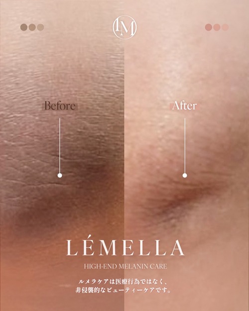https://beautysalon-cocoadoll.com/wp-content/uploads/2025/06/06_beforeafter.jpg