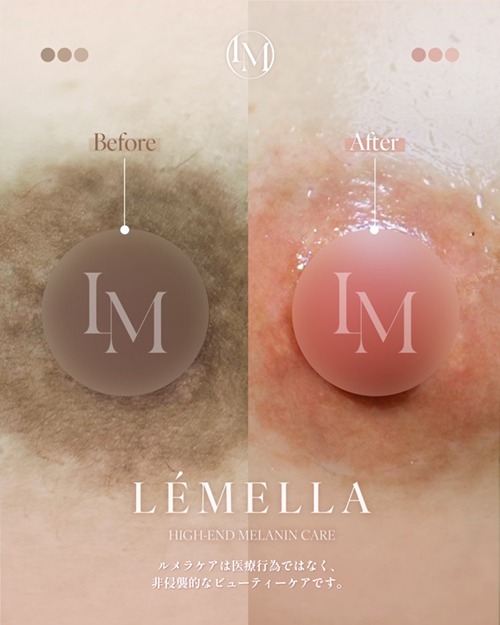 https://beautysalon-cocoadoll.com/wp-content/uploads/2025/06/07_beforeafter.jpg