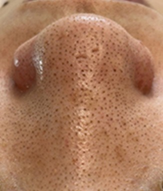 https://beautysalon-cocoadoll.com/wp-content/uploads/2025/06/befaft_img01.jpg