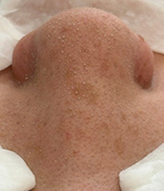 https://beautysalon-cocoadoll.com/wp-content/uploads/2025/06/befaft_img02.jpg