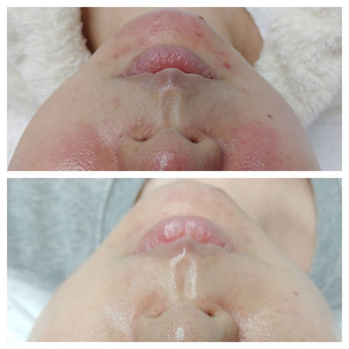 https://beautysalon-cocoadoll.com/wp-content/uploads/2025/06/lala_ba_02.jpg