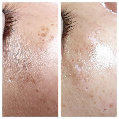 https://beautysalon-cocoadoll.com/wp-content/uploads/2025/06/lala_ba_06.jpg