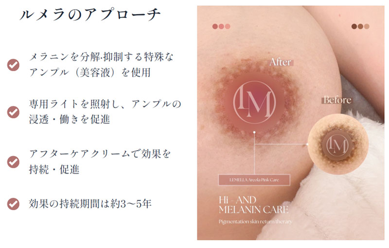 https://beautysalon-cocoadoll.com/wp-content/uploads/2025/06/lemella_02.jpg