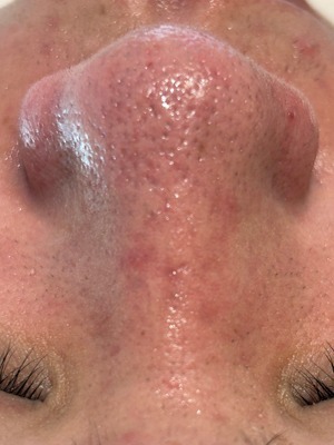 https://beautysalon-cocoadoll.com/wp-content/uploads/2025/06/step_img05.jpg