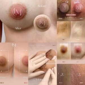 【LEMELLA】施術を検討中のお客様へ