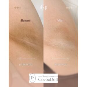 beforeafter《脇》ルメラ